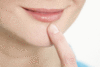 Herpesbläschen auf der Lippe