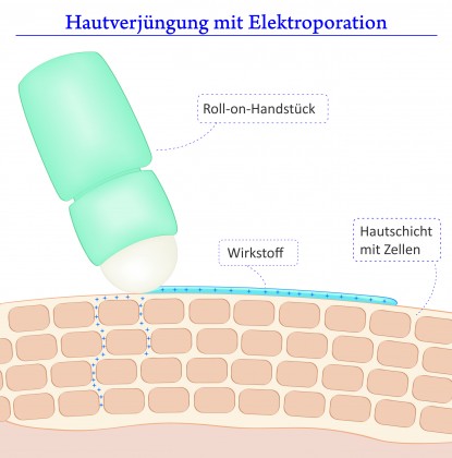 hautverjuengung_elektroporation